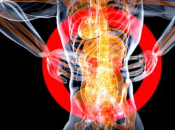 Back Pain